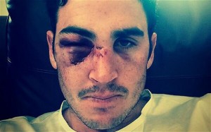 My name is Craig Kieswetter and I love morphine.